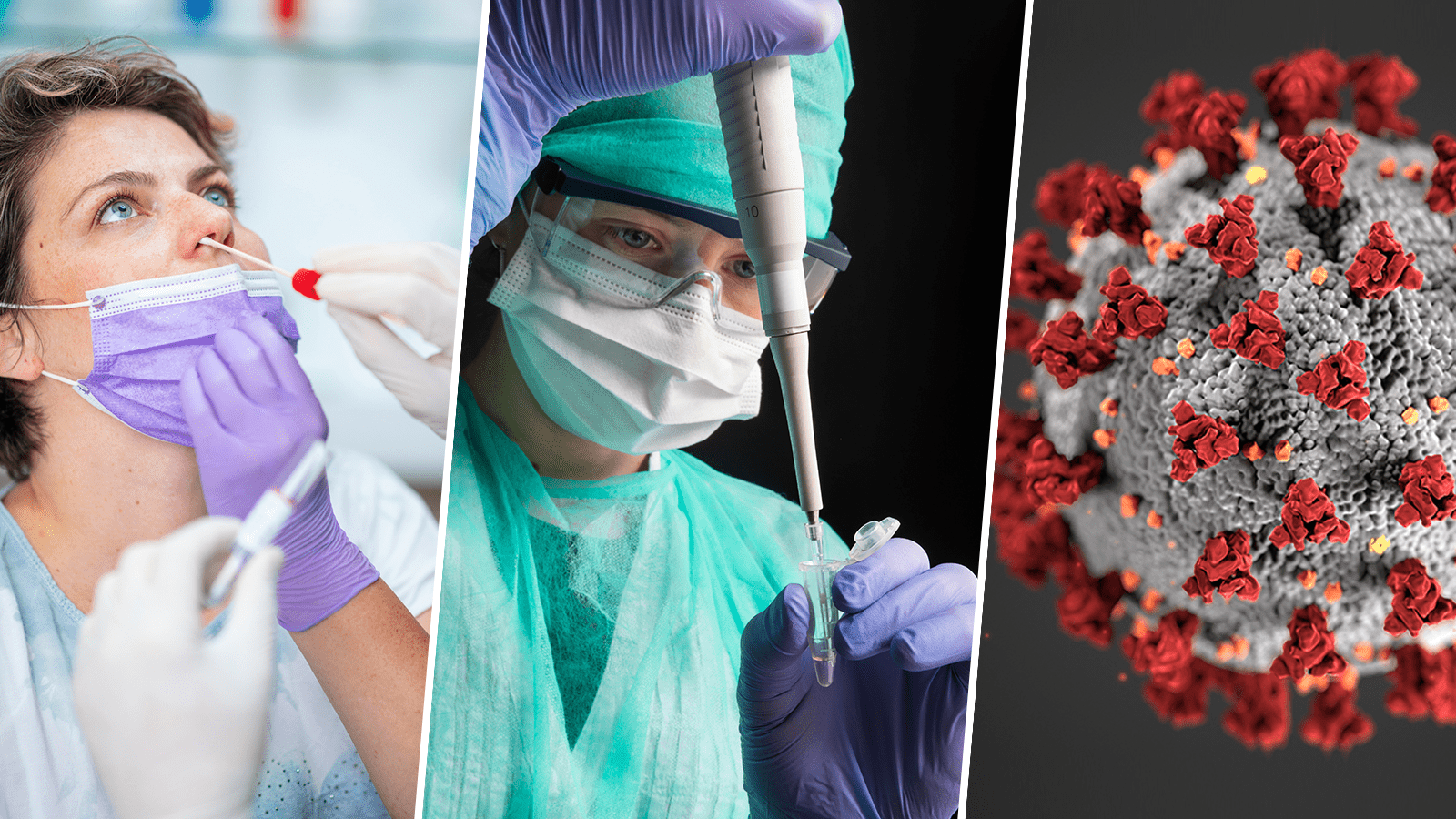 Coronavirus MERS, más letal que el COVID-19, reaparece en Qatar