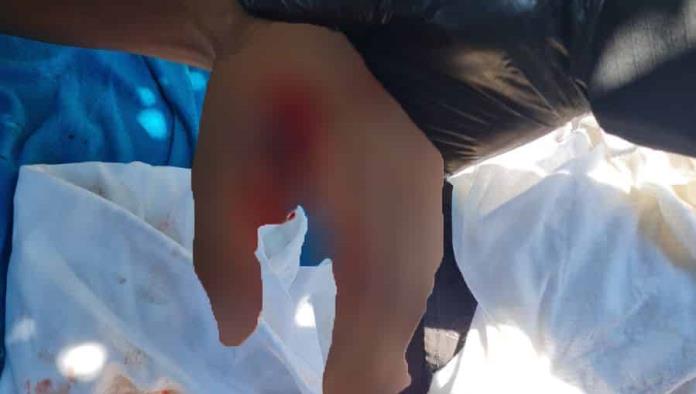 Intentan asaltar a migrante a machetazos