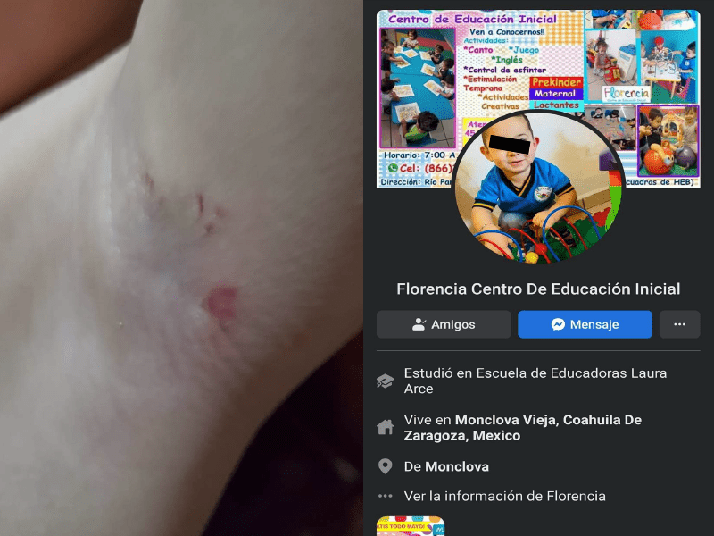 Denuncia mamá maltrato infantil contra un niño en guardería