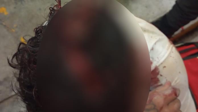 Le abre la cabeza de un machetazo