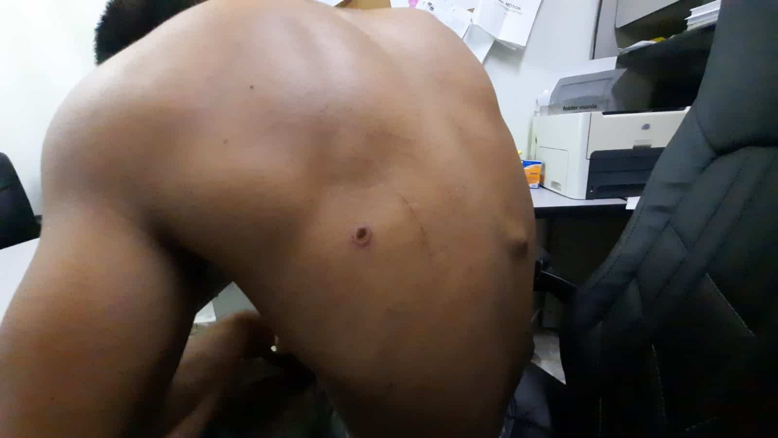 Le provocaron heridas en su cuerpo.