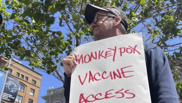 San Francisco se declaró en estado de emergencia por Viruela de Mono