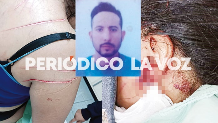 La mujer fue secuestrada por su propio esposo quien la violentó con cortes de navaja en brazos, hombros, espalda y cuello.