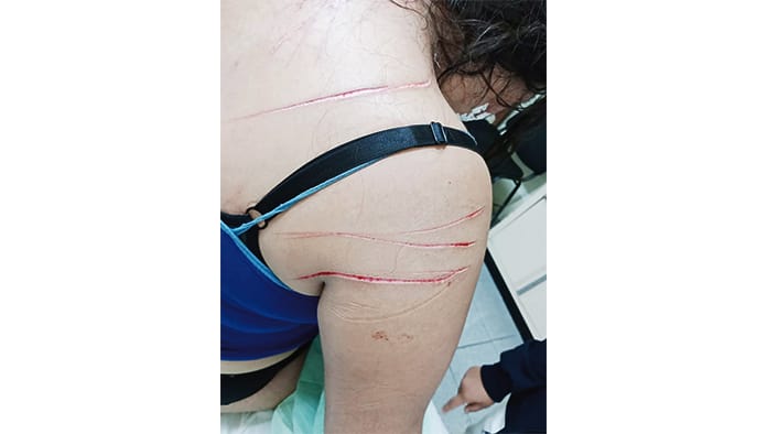 Por instrucciones del Alcalde Humberto Villarreal, se brindará total atención a la joven madre de familia que fue agredida por Juan Guajardo.