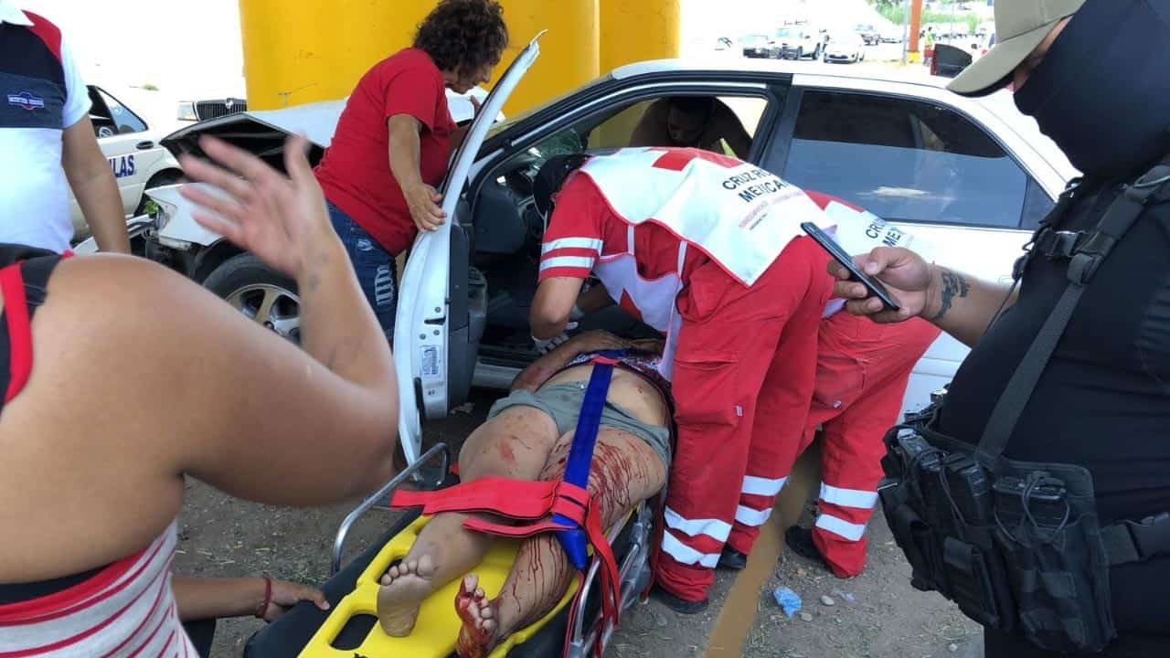 La chocan y pierde un ojo