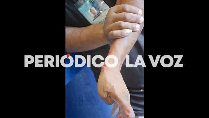 Se corta las venas frente a panadería