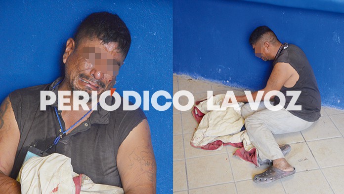 Se corta las venas frente a panadería