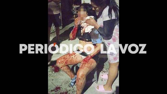 Apuñala a expareja en espalda y cuello