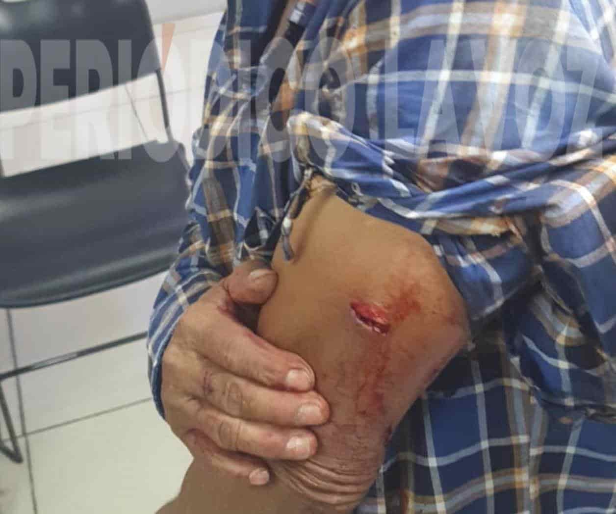 Lesiona pareja a gay con arma