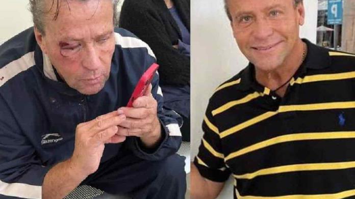 Alfredo Adame asegura que fue golpeado fuera de su casa Alfredo Adame asegura que fue golpeado fuera de su casa