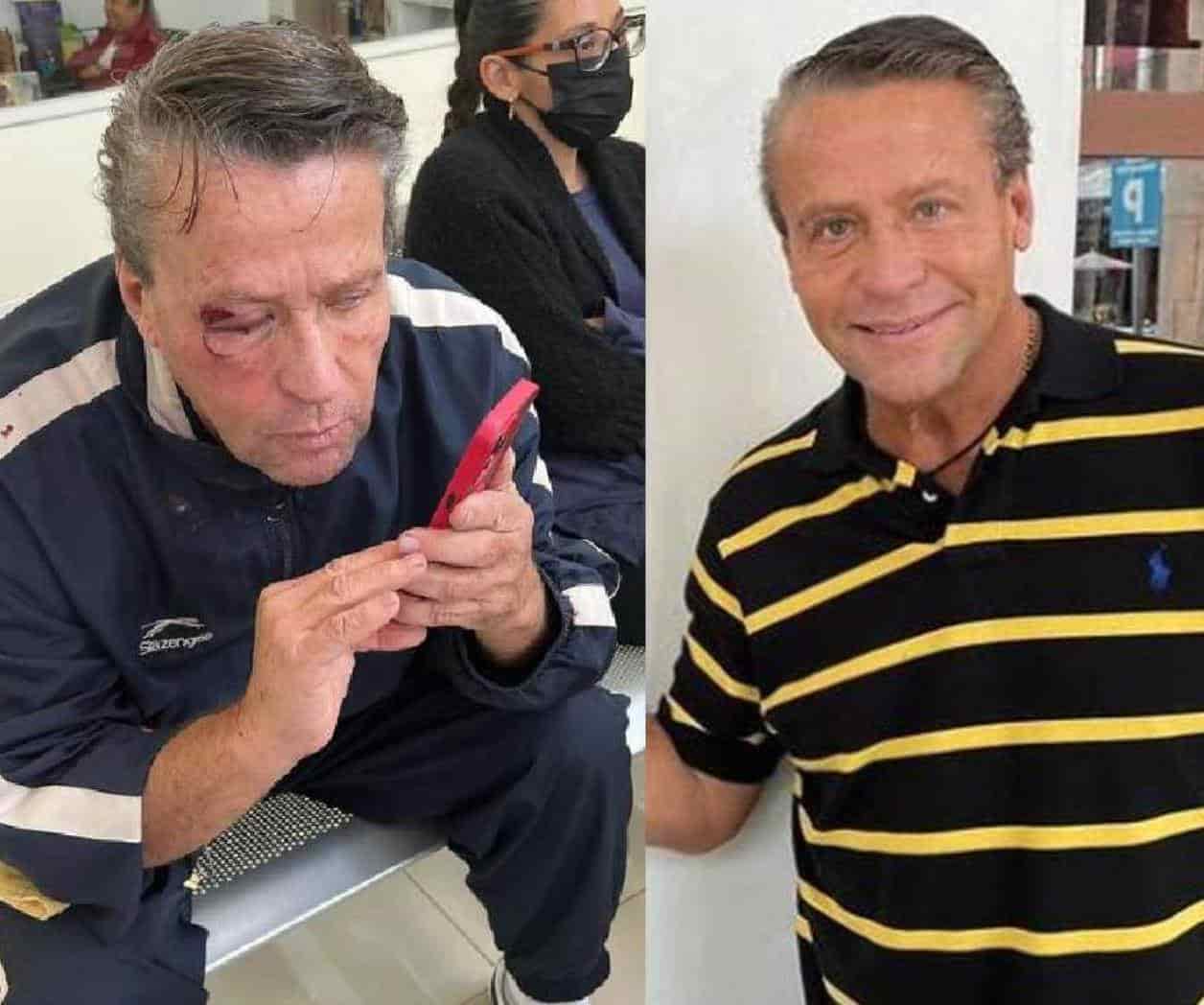 Alfredo Adame asegura que fue golpeado fuera de su casa