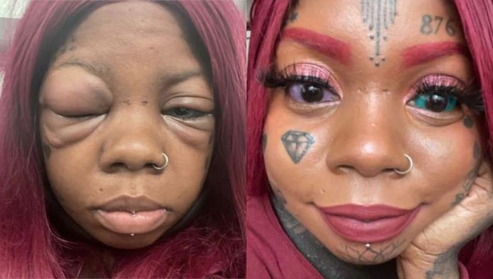 Se está quedando ciega: madre de familia se tatúa los ojos de colores