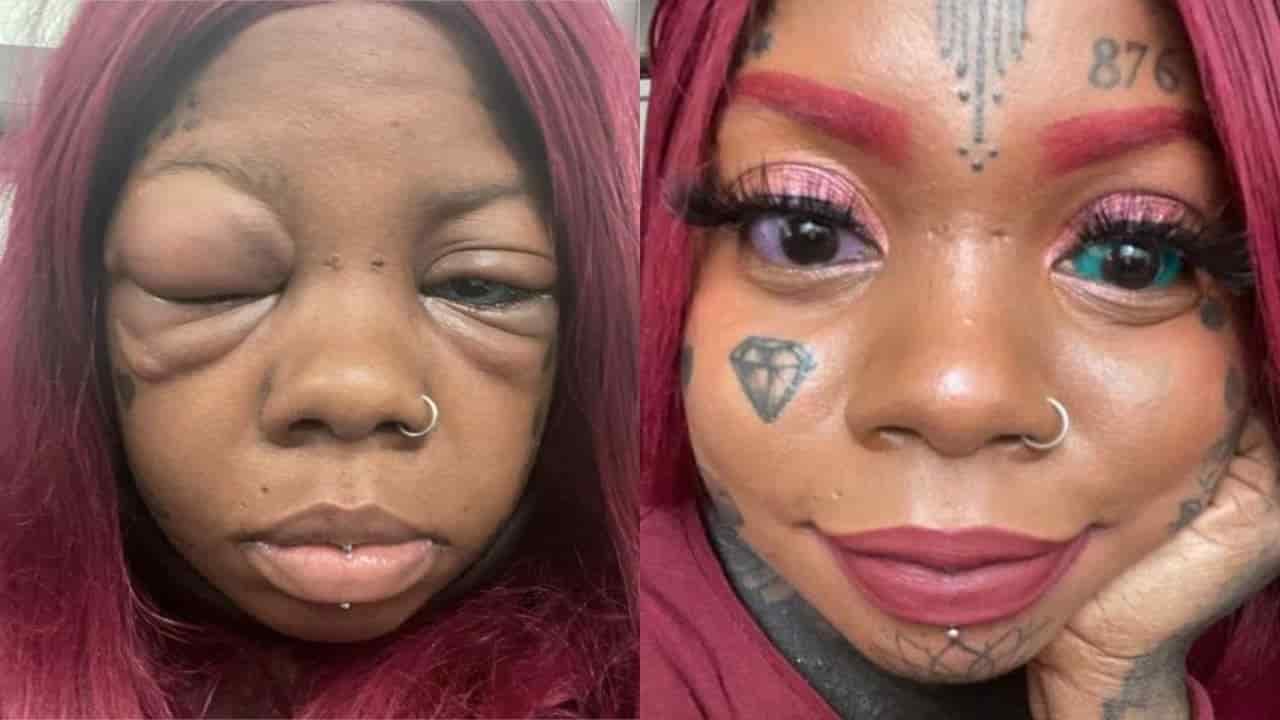 Se está quedando ciega: madre de familia se tatúa los ojos de colores