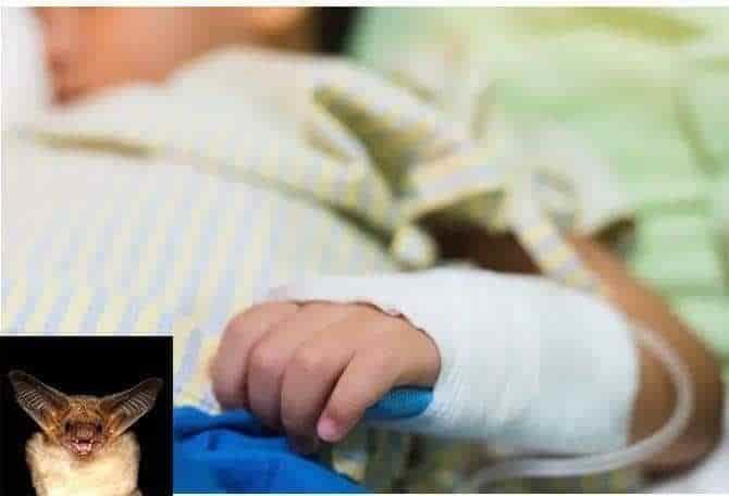 Fallece niño mordido por murciélago; se habría contagiado de rabia
