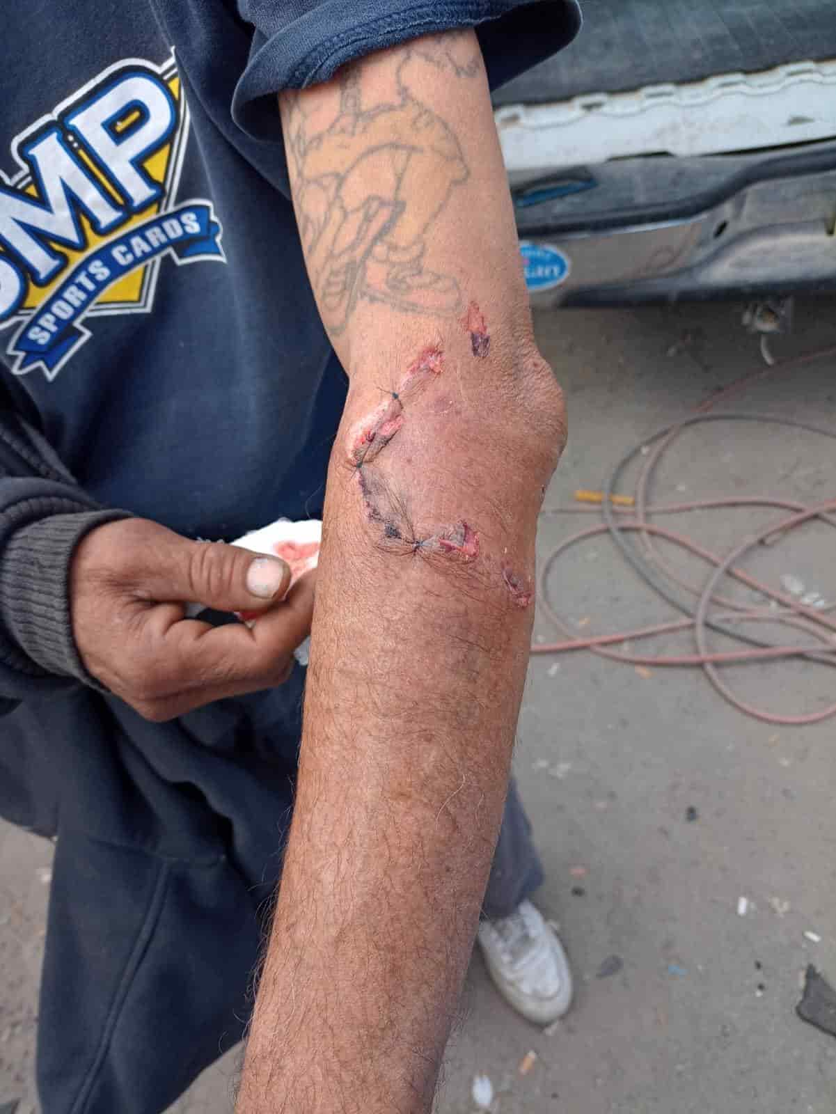 Trabajarán en antirrábicas