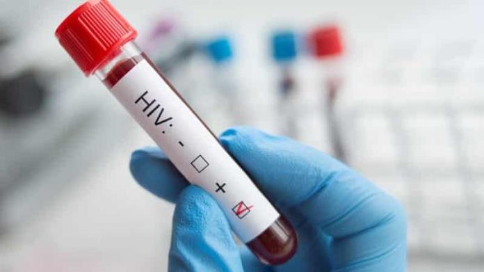 Hombre de Alemania se cura de VIH; Es el tercer caso confirmado en el mundo Hombre de Alemania se cura de VIH; Es el tercer caso confirmado en el mundo