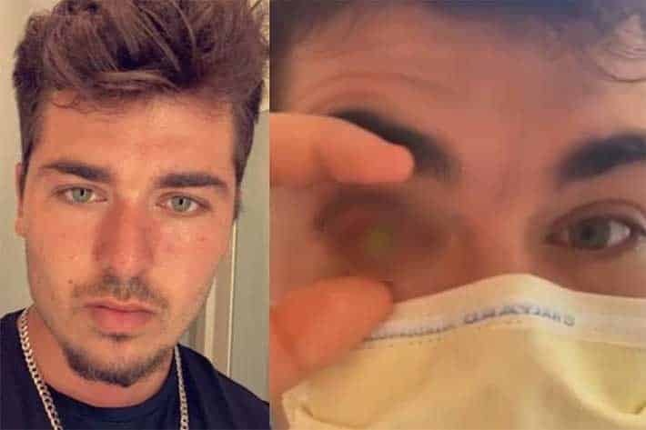 Duerme con sus pupilentes y queda ciego de un ojo