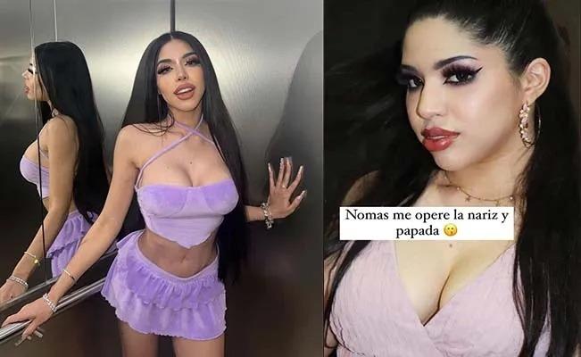 ¡No soporto!: Yeri Mua revela fotos de antes de sus cirugías