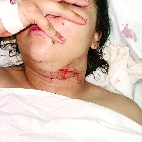 Agradece Abigail Arresto de agresor