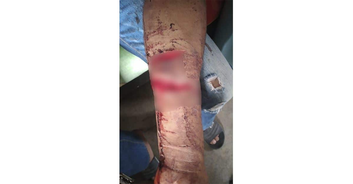 Grave joven por adicción
