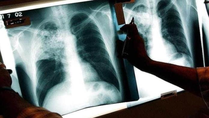 Detectan tuberculosis en centro de rescate