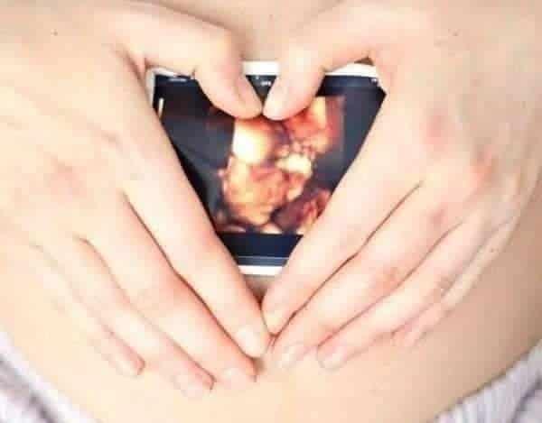 9 abortos al mes, lo que se atiende en promedio en PN