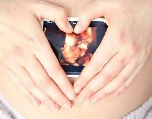 9 abortos al mes, lo que se atiende en promedio en PN