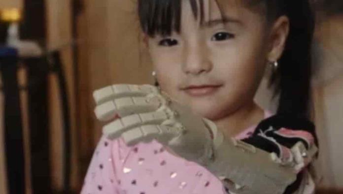 Recibe prótesis de antebrazo