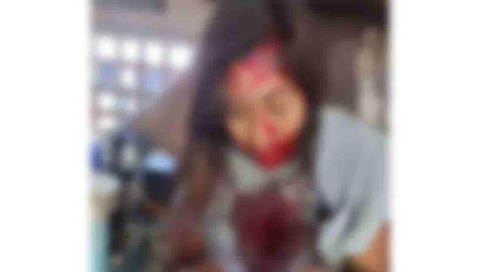 Golpean policías de Nueva Rosita a dos mujeres