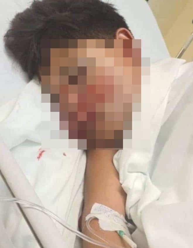 ¡Piden ayuda! Familia de menor accidentado en jaripeo solicita apoyo