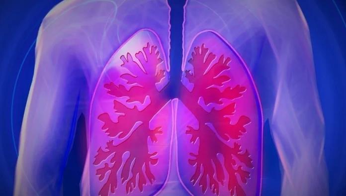 Aumentan casos de cáncer de pulmón en no fumadores