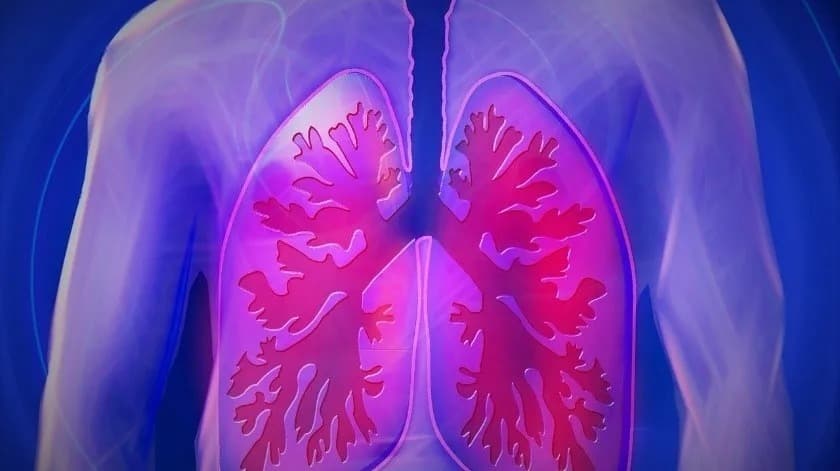 Aumentan casos de cáncer de pulmón en no fumadores