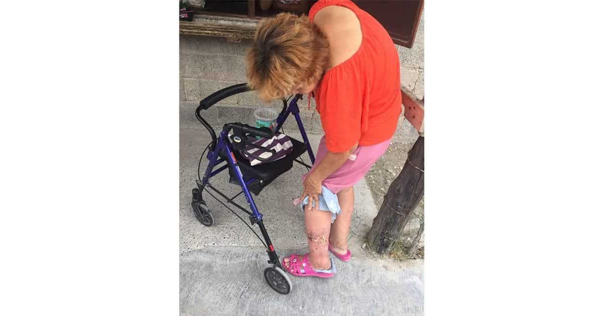 Solicitan apoyo para Lucy quien tiene una infección en su pierna.