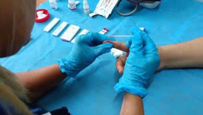 Registra comunidad gay 25 personas con VIH