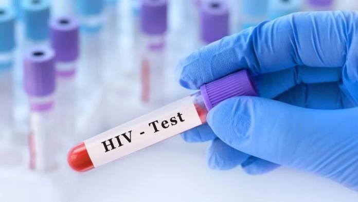 Indemnizan con 146 mil euros a italiana que contrajo VIH en laboratorio universitario