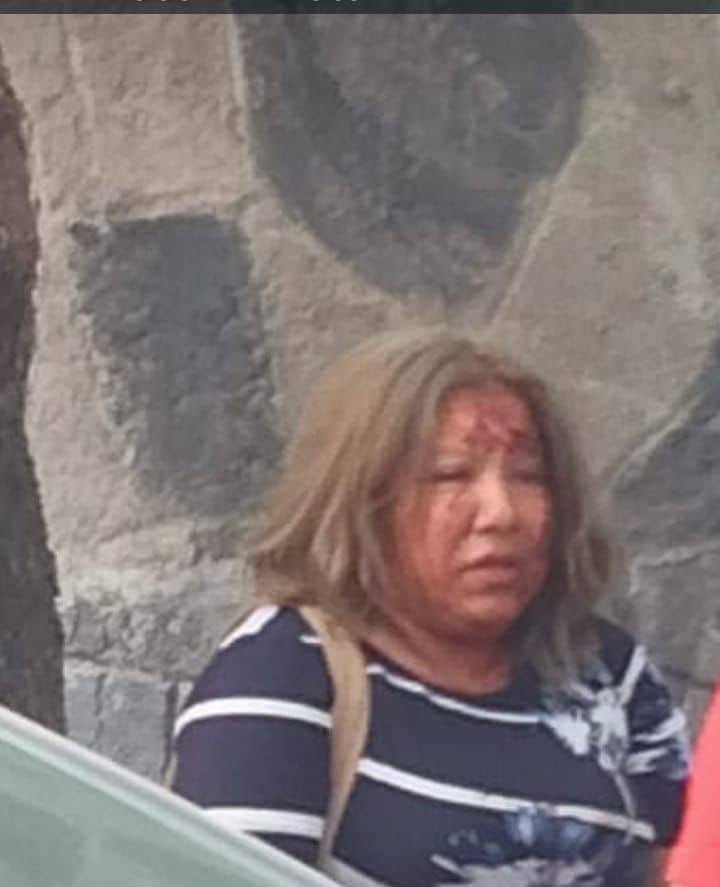 La deja ensangrentada