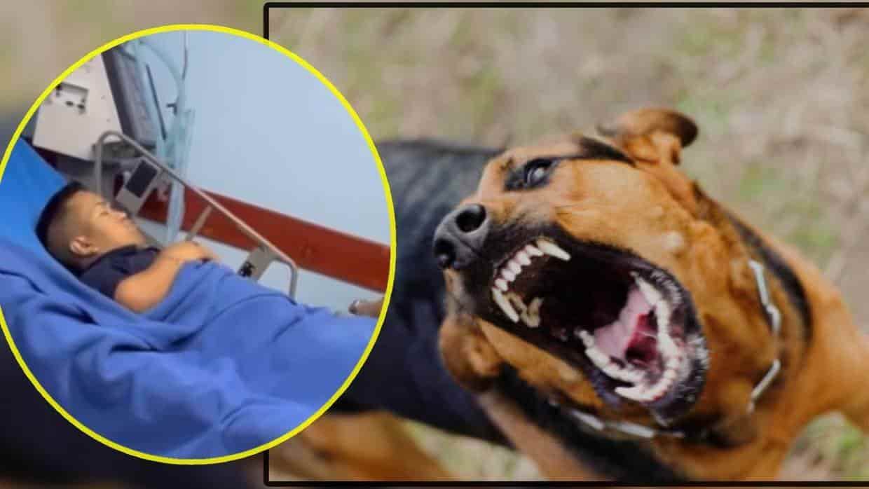 Medio Metro es hospitalizado de emergencia tras ser atacado por un perro rabioso