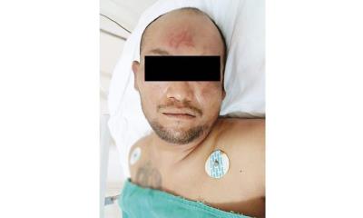 Ingresa hombre lesionado al Chavarría