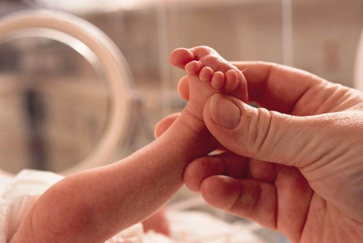 Bebé prematuro de 33 semanas muestra mejoría tras nacer en domicilio