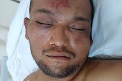 Hombre llega INCONSCIENTE al hospital con severas lesiones en la cabeza