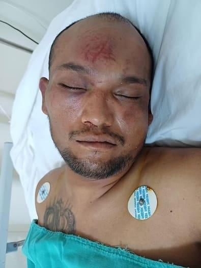 Hombre llega INCONSCIENTE al hospital con severas lesiones en la cabeza