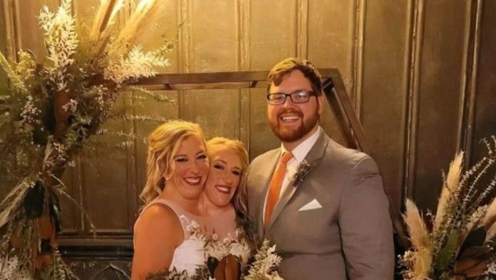Abby Hensel, la gemela siamesa, responde a críticas por su boda