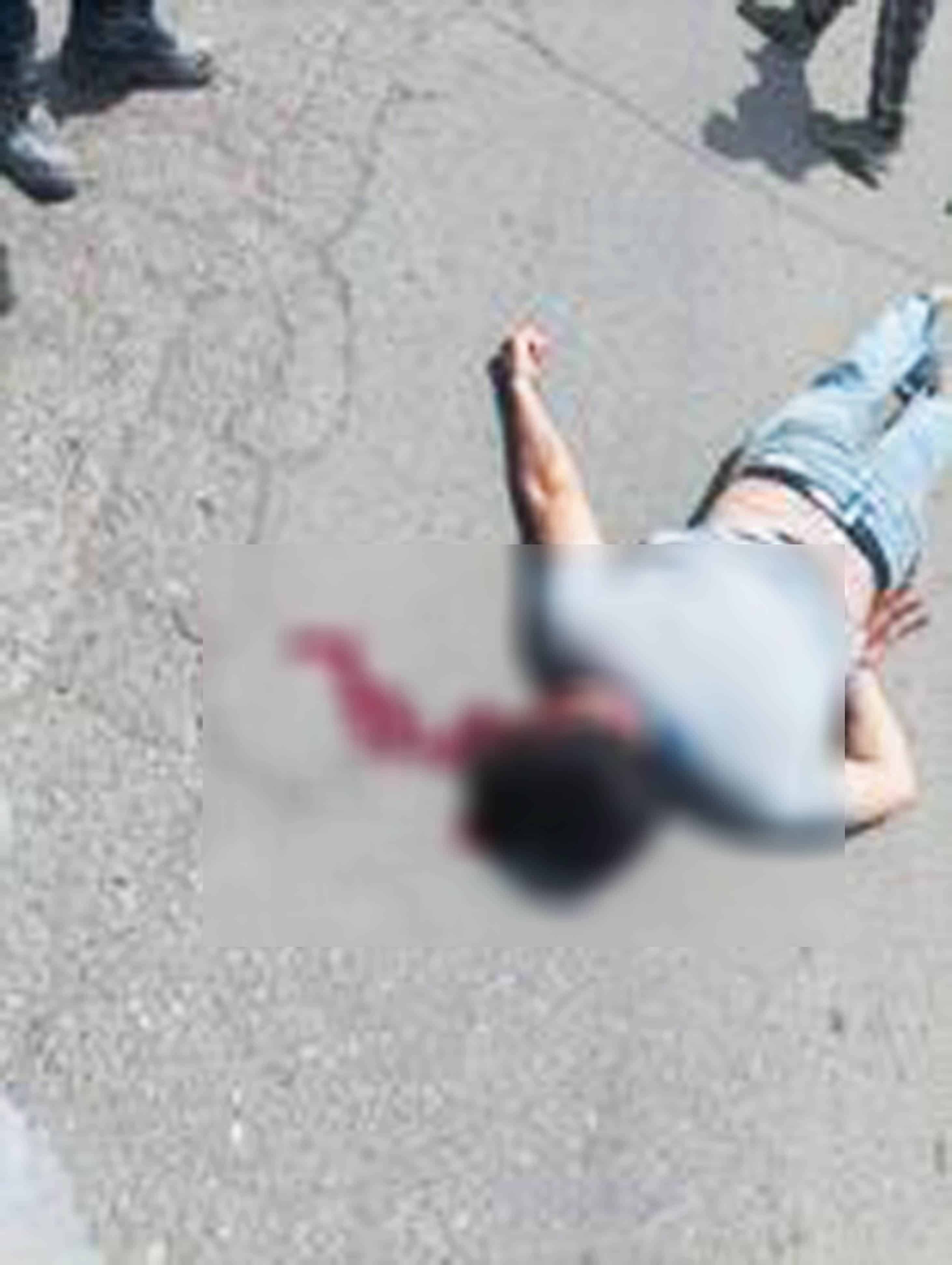 Conductor responsable de atropellar a joven, sería consignado ante un juez