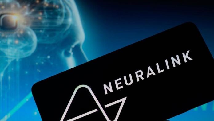 FDA autoriza nuevo implante del chip cerebral de Neuralink