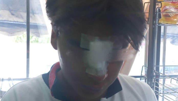 Atacan vándalos a alumno del Cecytec