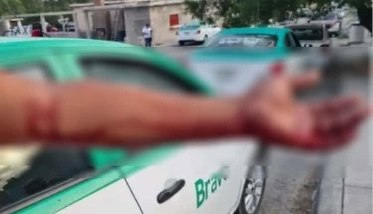 Taxista Agredido por Asaltante No Formaliza Denuncia