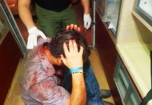Joven es brutalmente agredido en el Palenque Campo Real