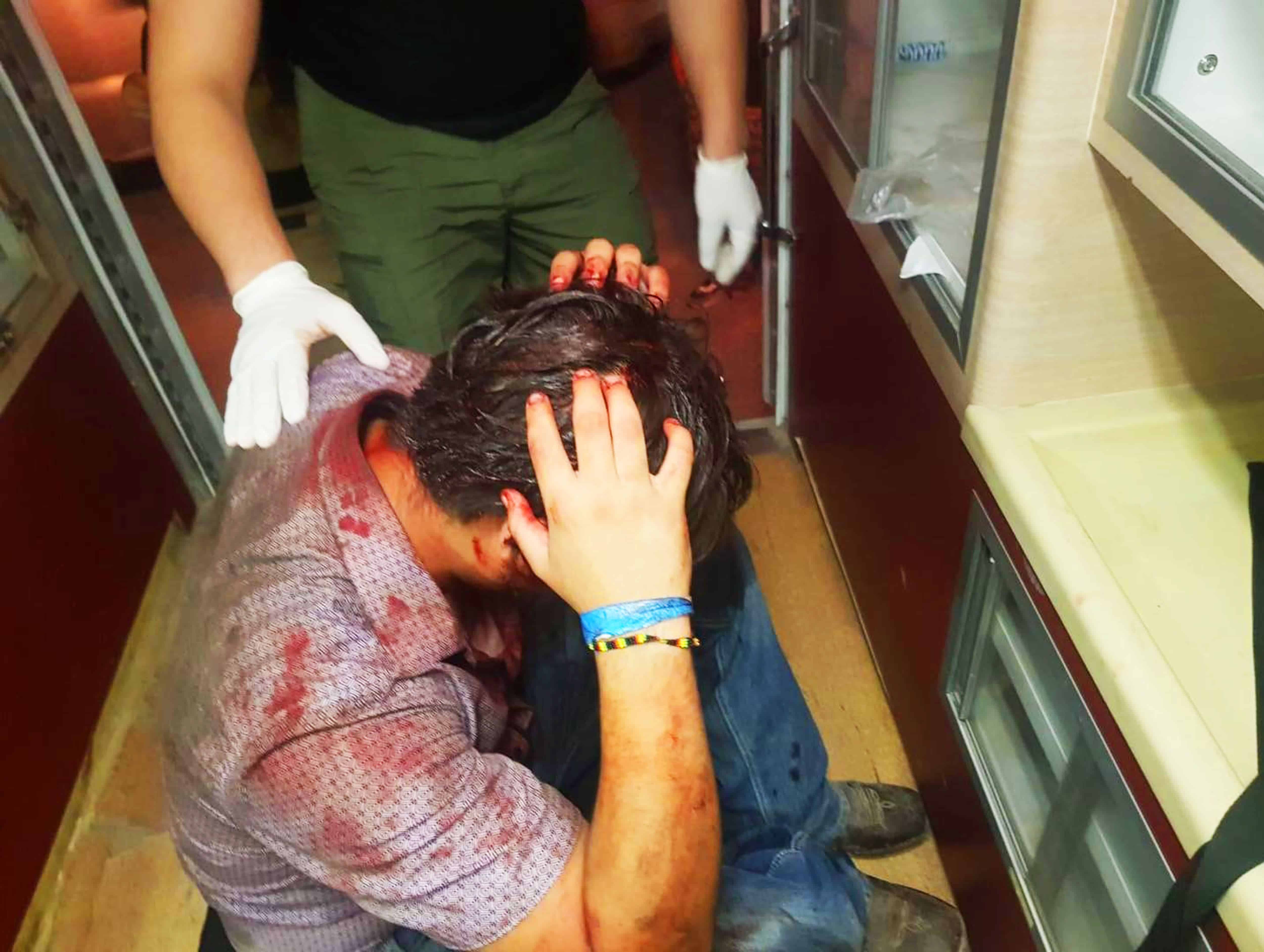 Joven es brutalmente agredido en el Palenque Campo Real
