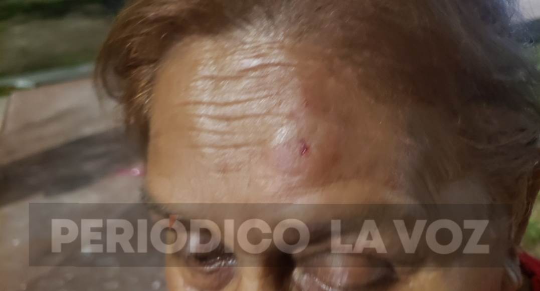 Pandilleros agreden adulta mayor
