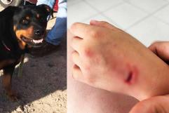 Niña sufre ataque de perros en colonia Cumbres